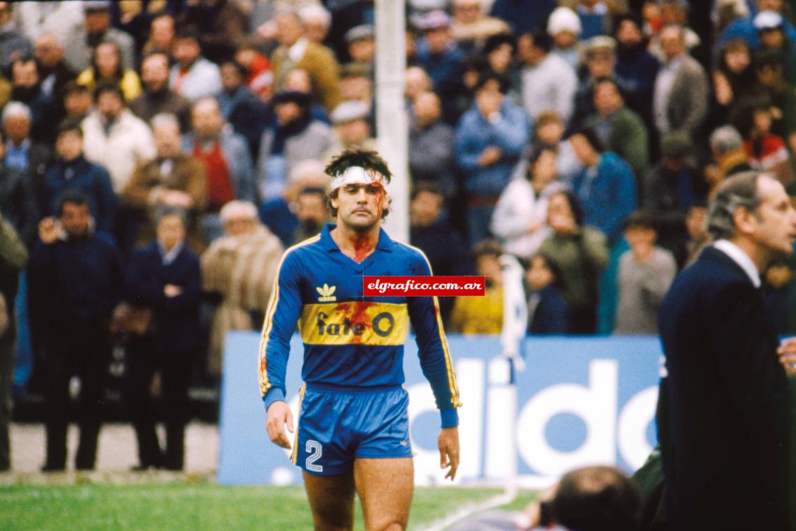 Imagen Después de un breve paso por Atlético Nacional de Colombia, Brown jugó en Boca Juniors en 1985. En la foto sangrando después de un choque con su compañero Hrabina.