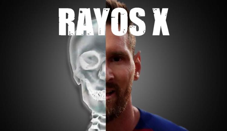 Imagen de Los Rayos X de Messi en la Champions League